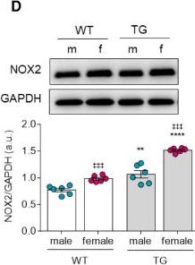 Fig.1.D showing Western Blotting in a Rattus norvegicus (Rat) sample from the publication: Oxidative stress and inflammation distinctly drive molecular mechanisms of diastolic dysfunction and remodeling in female and male heart failure with preserved ejection fraction rats.