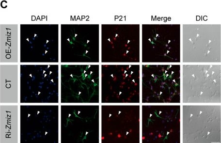 Fig.3.C showing Immunocytochemistry-immunofluorescence in a Mus musculus (House mouse) sample from the publication: Regulation of Neuronal Senescence by Srebf2 and Zmiz1 Reveals Mechanisms of Aging-Related Neurodegeneration.