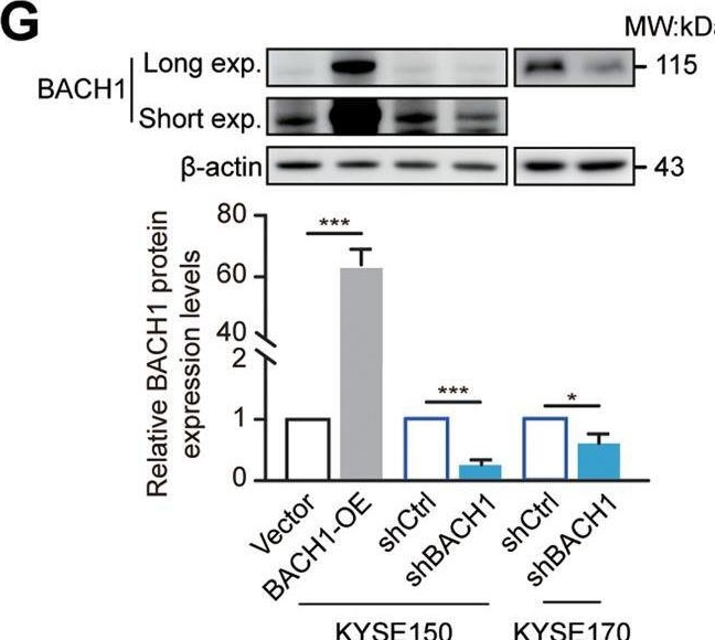 Fig.3.G showing Western Blotting in a Homo sapiens (Human) sample from the publication: BACH1-induced ferroptosis drives lymphatic metastasis by repressing the biosynthesis of monounsaturated fatty acids.