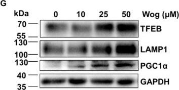 Fig.9.G showing Western Blotting from the publication: Wogonin, a bioactive flavonoid from Scutellaria baicalensis, alleviates alcoholic pancreatitis via AMPK-mediated TFEB activation.