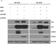 Fig.1.A showing Western Blotting in a Homo sapiens (Human) sample from the publication: Cell type of origin as well as genetic alterations contribute to breast cancer phenotypes.