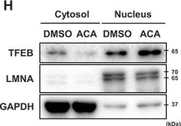 Fig.5.H showing Western Blotting in a Mus musculus (House mouse) sample from the publication: Inhibition of lysosomal LAMTOR1 increases autophagy by suppressing the MTORC1 pathway to ameliorate lipid accumulations in MAFLD.
