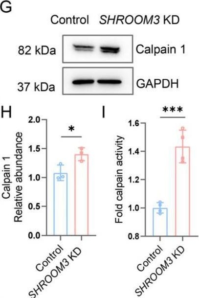 Fig.6.G showing Western Blotting from the publication: SHROOM3 Deficiency Aggravates Adriamycin-Induced Nephropathy Accompanied by Focal Adhesion Disassembly and Stress Fiber Disorganization.