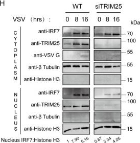 Fig.7.H showing Western Blotting in a Mesocricetus auratus (Golden Syrian hamster) sample from the publication: TRIM25 promotes antiviral innate immune response by stabilizing IRF7 and its nuclear translocation.