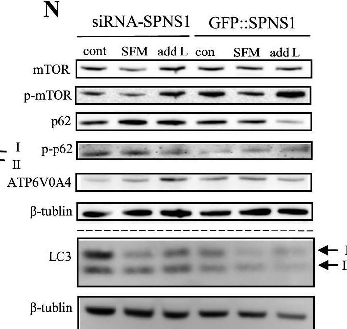 Fig.2.N showing Western Blotting in a Homo sapiens (Human) sample from the publication: L-leucine and SPNS1 coordinately ameliorate dysfunction of autophagy in mouse and human Niemann-Pick type C disease.