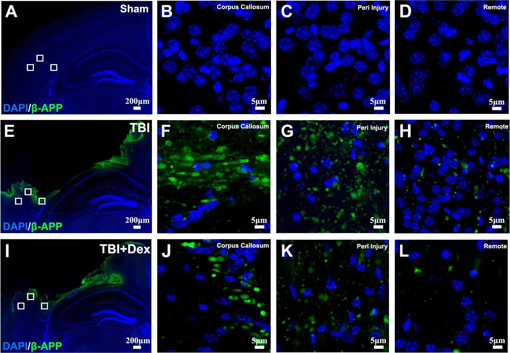 Fig.4.A showing Immunohistochemistry-immunofluorescence in a Mus musculus (House mouse) sample from the publication: Neuroprotective effect of dexmedetomidine in a murine model of traumatic brain injury.