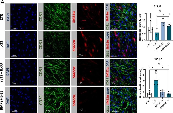 Fig.4.A from the publication: BMP9 Modulates IL-33 Signaling to Mitigate EndMT in Pulmonary Arterial Hypertension.
