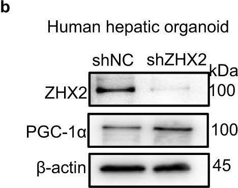 Fig.6.B showing Western Blotting from the publication: ZHX2 emerges as a negative regulator of mitochondrial oxidative phosphorylation during acute liver injury.