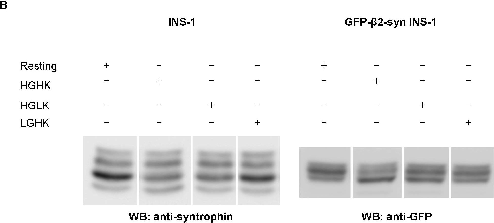 Fig.1.B showing Western Blotting from the publication: β2-Syntrophin is a Cdk5 substrate that restrains the motility of insulin secretory granules.