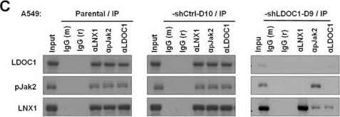 Fig.6.C showing Western Blotting in a Homo sapiens (Human) sample from the publication: Novel STAT3 Inhibitor LDOC1 Targets Phospho-JAK2 for Degradation by Interacting with LNX1 and Regulates the Aggressiveness of Lung Cancer.