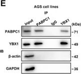 Fig.5.E showing Western Blotting from the publication: 8-Oxoguanine Modified CircMTUS1 Drives PABPC1 Phase Separation to Promote Gastric Cancer Progression and Cisplatin Resistance via Autophagy.