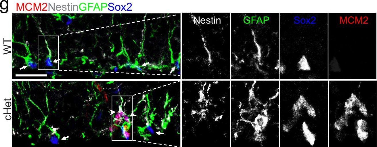Fig.1.G showing Immunohistochemistry-immunofluorescence in a Mus musculus (House mouse) sample from the publication: Epigenetic maintenance of adult neural stem cell quiescence in the mouse hippocampus via Setd1a.