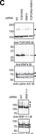 Fig.9.C showing Western Blotting in a Homo sapiens (Human) sample from the publication: PML mutants from arsenic-resistant patients reveal SUMO1-TOPORS and SUMO2/3-RNF4 degradation pathways.