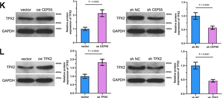 Fig.7.K showing Western Blotting from the publication: CEP55 promotes prostate cancer progression via TPX2-dependent activation of AURKA-PI3K-AKT signaling and inhibition of ferroptosis.
