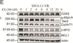 Fig.4.E showing Western Blotting from the publication: DualPG-DTA: A Large Language Model-Powered Graph Neural Network Framework for Enhanced Drug-Target Affinity Prediction and Discovery of Novel CDK9 Inhibitors Exhibiting In Vivo Anti-Leukemia Activity.
