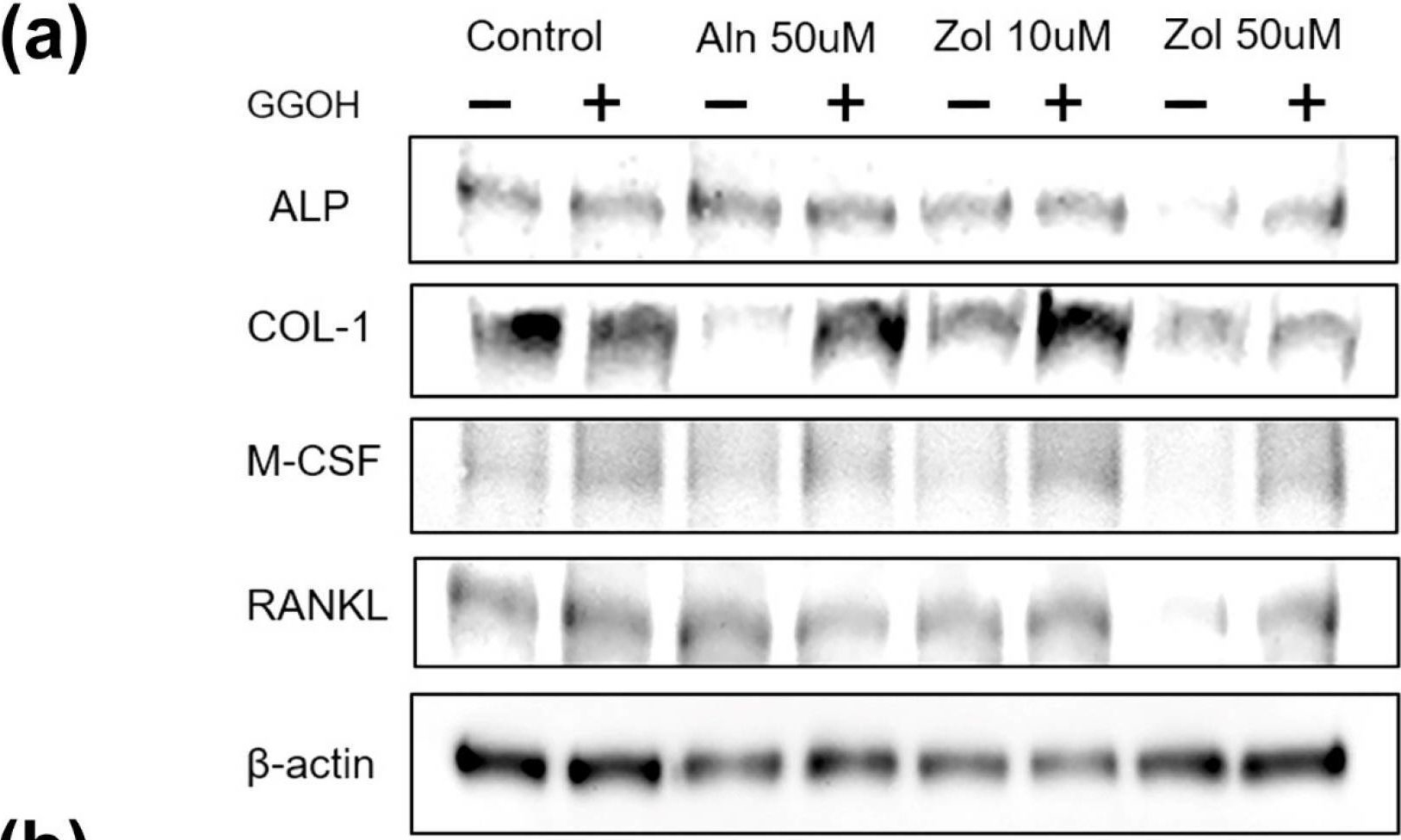 Fig.5.A showing Western Blotting in a Homo sapiens (Human) sample from the publication: Geranylgeraniol Application in Human Osteoblasts and Osteoclasts for Reversal of the Effect of Bisphosphonates.