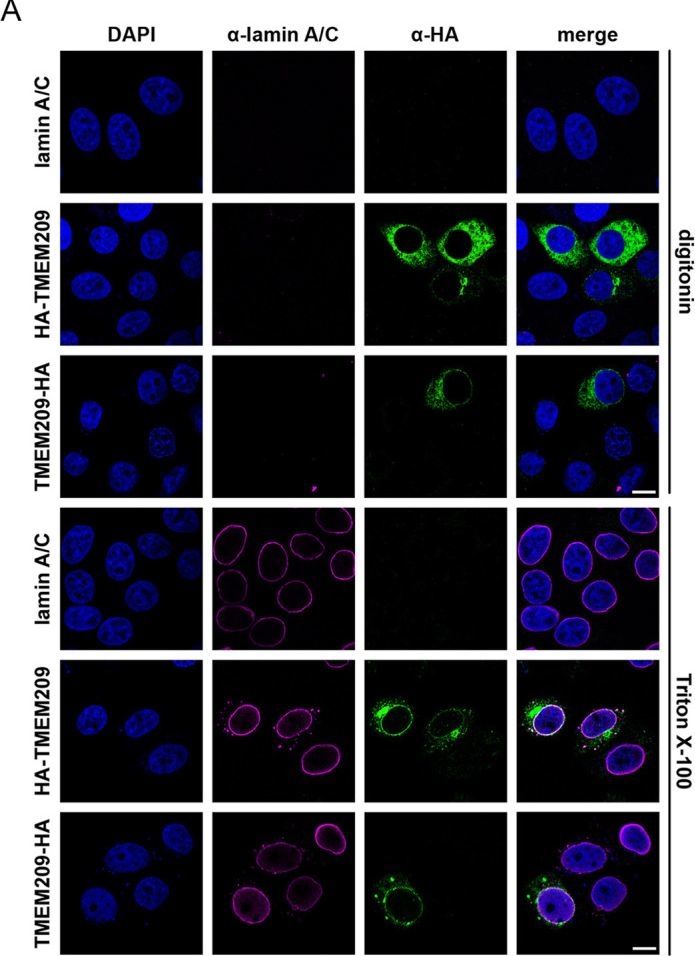 Fig.1.A showing Immunocytochemistry-immunofluorescence from the publication: The nuclear envelope protein TMEM209 is an integral component of the nuclear pore complex and interacts with Nup210.