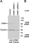 Fig.1.A showing Western Blotting from the publication: The Cellular Distribution of RanGAP1 Is Regulated by CRM1-Mediated Nuclear Export in Mammalian Cells.