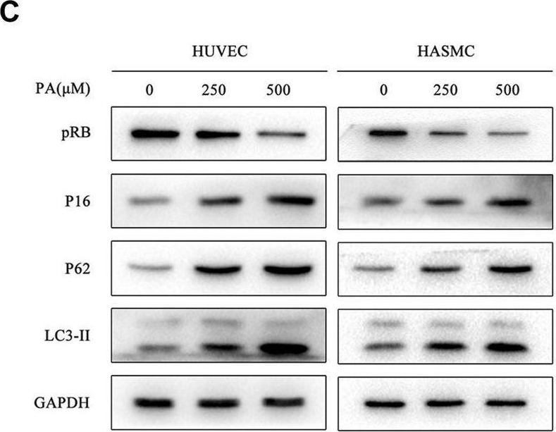 Fig.3.C showing Western Blotting in a Homo sapiens (Human) sample from the publication: Palmitic Acid, A Critical Metabolite, Aggravates Cellular Senescence Through Reactive Oxygen Species Generation in Kawasaki Disease.