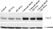 Fig.1.A showing Western Blotting in a Mus musculus (House mouse) sample from the publication: Antitumor enhancement of celecoxib, a selective Cyclooxygenase-2 inhibitor, in a Lewis lung carcinoma expressing Cyclooxygenase-2.