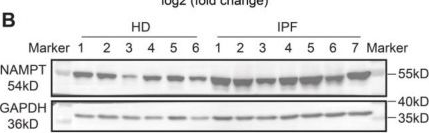 Fig.1.B showing Western Blotting in a Mus musculus (House mouse) sample from the publication: Nicotinamide phosphoribosyltransferase prompts bleomycin-induced pulmonary fibrosis by driving macrophage M2 polarization in mice.
