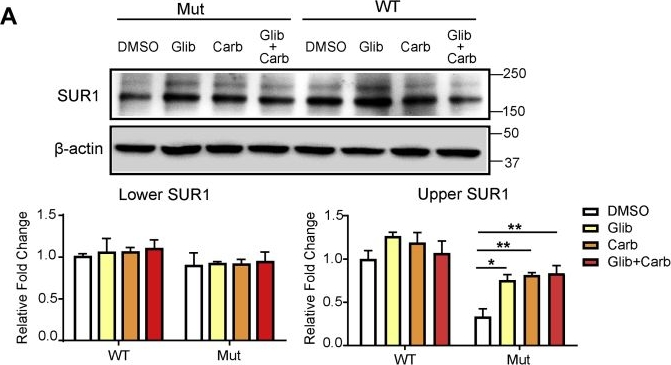Fig.9.A showing Western Blotting from the publication: Carbamazepine promotes surface expression of mutant Kir6.2-A28V ATP-sensitive potassium channels by modulating Golgi retention and autophagy.