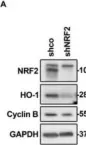 Fig.1.A showing Western Blotting from the publication: Transcription Factor NRF2 Participates in Cell Cycle Progression at the Level of G1/S and Mitotic Checkpoints.