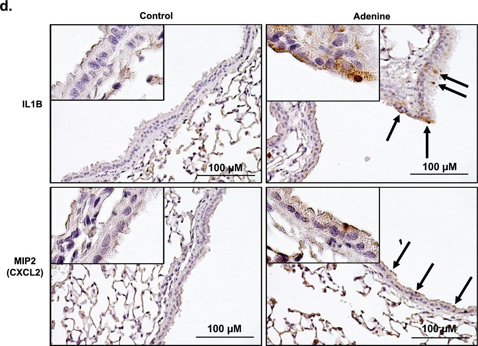 Fig.2.D showing Immunohistochemistry in a Mus musculus (House mouse) sample from the publication: Phosphate induces inflammation and exacerbates injury from cigarette smoke in the bronchial epithelium.