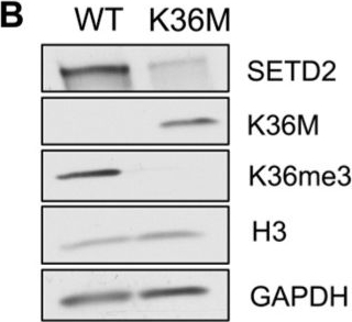 Fig.3.B showing Western Blotting in a Homo sapiens (Human) sample from the publication: Pharmacologic and Oncohistone Inhibition of SETD2 Converge on Genomic Instability.