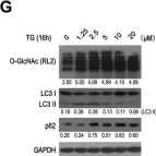 Fig.1.G showing Western Blotting in a Homo sapiens (Human) sample from the publication: Blockage of O-linked GlcNAcylation induces AMPK-dependent autophagy in bladder cancer cells.