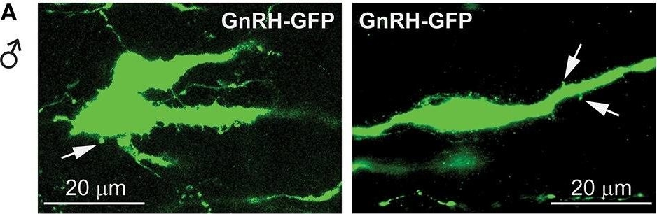 Fig.12.A showing Immunohistochemistry in a Mus musculus (House mouse) sample from the publication: Diet-Induced Obesity Elicits Macrophage Infiltration and Reduction in Spine Density in the Hypothalami of Male but Not Female Mice.