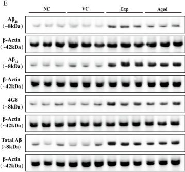 Fig.4.E showing Western Blotting from the publication: Establishment and Characterization of an Aβ-Related Alzheimer's Disease-like Tree Shrew Model Following CA1-Coordinate-Directed Stereotaxic AAV Delivery of Human Triple-Mutant APP.
