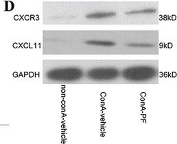 Fig.5.D showing Western Blotting in a Mus musculus (House mouse) sample from the publication: Paeoniflorin exerts a nephroprotective effect on concanavalin A-induced damage through inhibition of macrophage infiltration.
