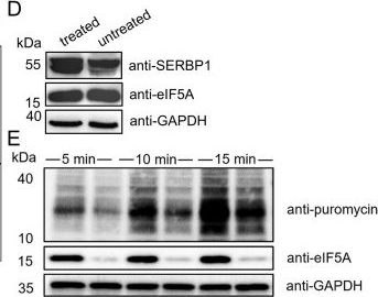 Fig.2.D showing Western Blotting in a Rattus norvegicus (Rat) sample from the publication: rRNA expansion segments mediate ribosome dimerization as a conserved stress response.
