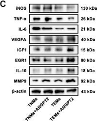 Fig.2.C showing Western Blotting in a Homo sapiens (Human) sample from the publication: ANGPT2/Tie2 Enhances H3K18la-Mediated Macrophage M2 Polarization to Promote Endothelial Cell Proliferation in the Chronically Ischaemic Brain.