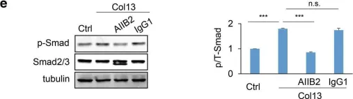 Fig.6.E showing Western Blotting from the publication: Membrane associated collagen XIII promotes cancer metastasis and enhances anoikis resistance.