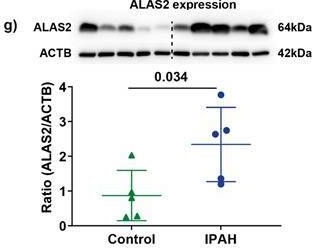 Fig.1.G showing Western Blotting from the publication: Mitochondrial Respiration in Peripheral Blood Mononuclear Cells Negatively Correlates with Disease Severity in Pulmonary Arterial Hypertension.