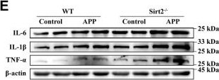 Fig.7.E showing Western Blotting in a Mus musculus (House mouse) sample from the publication: Mechanisms by which SIRT2 modulates alveolar macrophage immunoreactivity to intervene in Actinobacillus pleuropneumoniae infection in piglets under cold stimulation.