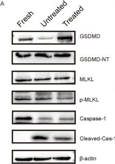 Fig.6.A showing Western Blotting in a Mus musculus (House mouse) sample from the publication: Induction of stress granules alleviates programmed cell death induced by lysosomal damage during NK cell cryopreservation.