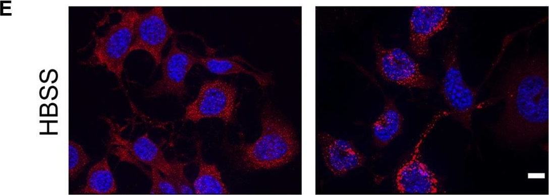 Microtubule-dependent and independent roles of spastin in lipid droplet dispersion and biogenesis.