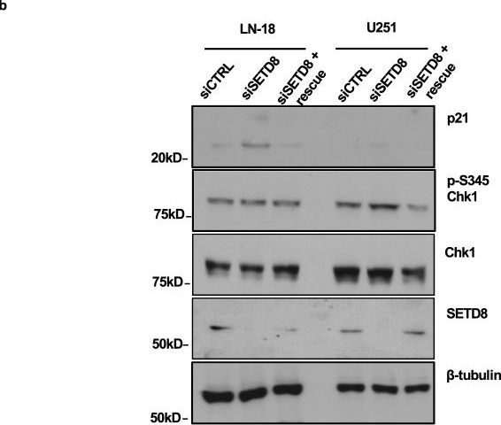 Fig.3.B showing Western Blotting from the publication: Targeted inhibition of the methyltransferase SETD8 synergizes with the Wee1 inhibitor adavosertib in restraining glioblastoma growth.