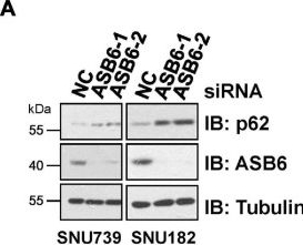 Fig.6.A showing Western Blotting from the publication: CUL5-ASB6 Complex Promotes p62/SQSTM1 Ubiquitination and Degradation to Regulate Cell Proliferation and Autophagy.