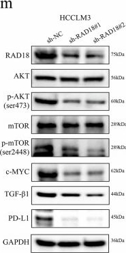 Fig.10.M showing Western Blotting in a Homo sapiens (Human) sample from the publication: RAD18 facilitates cancer progression and immunosuppression via the AKT/mTOR/c-Myc axis: a multi-omics analysis.