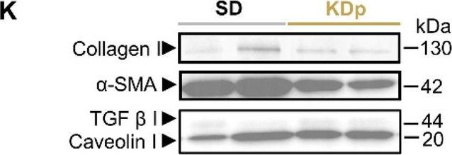 Fig.1.K showing Western Blotting in a Rattus norvegicus (Rat) sample from the publication: Ketosis prevents abdominal aortic aneurysm rupture through C-C chemokine receptor type 2 downregulation and enhanced extracellular matrix balance.