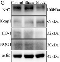 Fig.1.G showing Western Blotting from the publication: M2 macrophage-derived exosomes improves secondary lymphedema through cellular mitochondrial homeostasis regulation via the Keap1-Nrf2/mPTP axis.