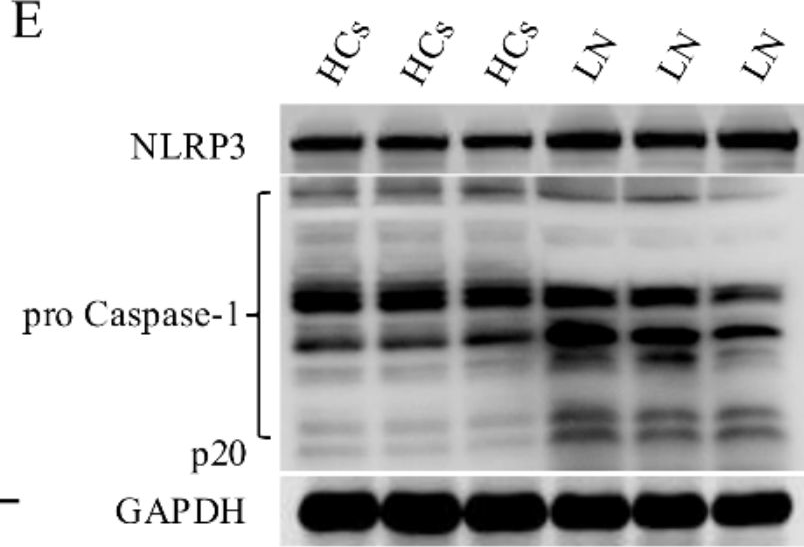 Fig.3.E showing Western Blotting from the publication: Novel approach to alleviate lupus nephritis: targeting the NLRP3 inflammasome in CD8+CD69+CD103+ TRM cells.