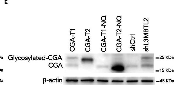 Fig.2.E showing Western Blotting in a Homo sapiens (Human) sample from the publication: L3MBTL2-mediated CGA transcriptional suppression promotes pancreatic cancer progression through modulating autophagy.