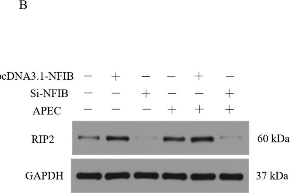 Fig.7.B showing Western Blotting from the publication: Transcriptional Regulation of RIP2 Gene by NFIB Is Associated with Cellular Immune and Inflammatory Response to APEC Infection.