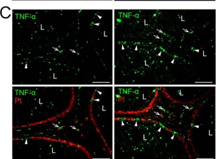 Fig.1.C showing Immunohistochemistry-immunofluorescence from the publication: SARS-CoV-2 triggers an NF-kB-driven proliferative response in epididymal clear cells of K18-hACE2 mice.