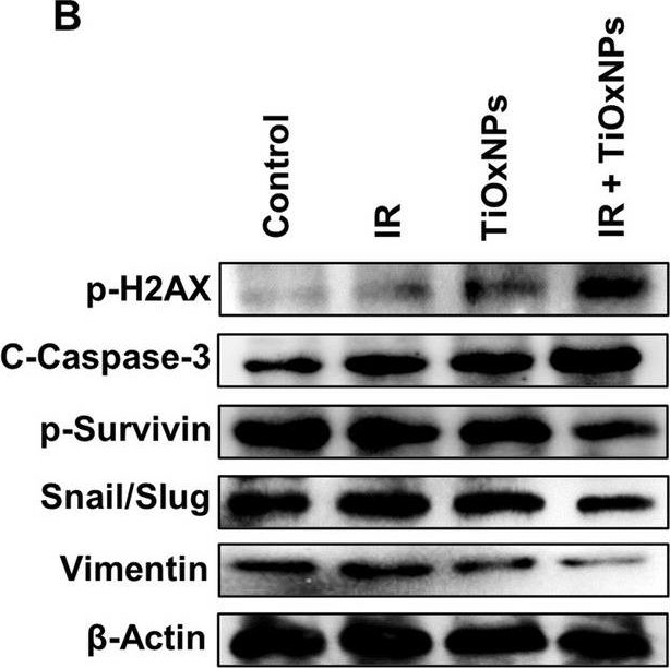 Fig.5.B showing Western Blotting in a Homo sapiens (Human) sample from the publication: Reactive oxygen species-inducing titanium peroxide nanoparticles as promising radiosensitizers for eliminating pancreatic cancer stem cells.